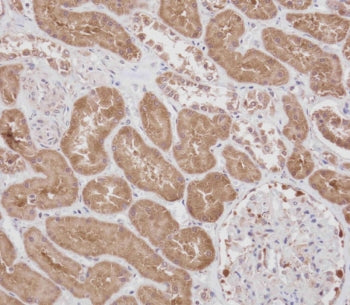 RPS18 Antibody
