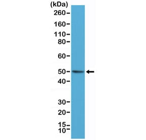 BAG-1 Antibody / BAG-1L p50 specific