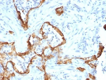 KRT8 Antibody / Cytokeratin 8