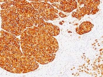 Tyrosinase Antibody
