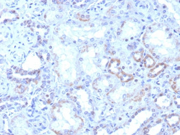 RORC Antibody / ROR gamma