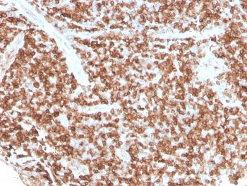 IHC staining of FFPE human tonsil with recombinant CD74 antibody (clone rCLIP/813). HIER: boil tissu