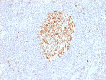 MSH6 Antibody