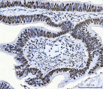 CFIm68 Antibody / CPSF6