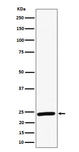 Western blot analysis of RAB8A expression in human HeLa cell lysate using RAB8A antibody. Predicted