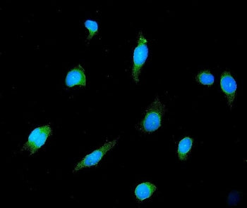 GAD65 Antibody / GAD2