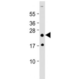 HOXA7 Antibody (Center Region)