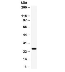 Western blot testing of human 22RV1 cell lysate with HE4 antibody. Expected molecular weight: 13-25