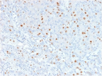 Annexin A1 Antibody