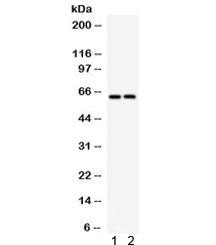 SLC22A2 Antibody