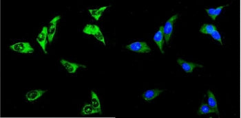 RENT3A Antibody / UPF3A