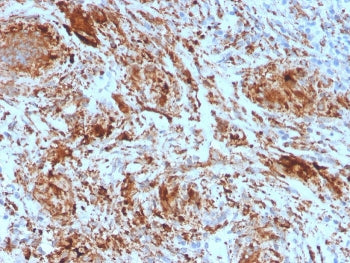 IHC staining of FFPE human tonsil with TIM3 antibody. HIER: boil tissue sections in pH 9 10mM Tris w