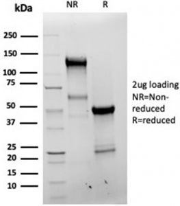 SDS-PAGE analysis of purified, BSA-free recombinant Bcl-X antibody (clone BCL2L1/4509R) as confirmat