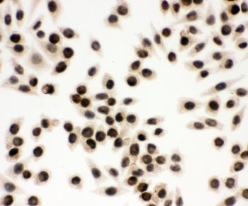 EWS Antibody / EWSR1