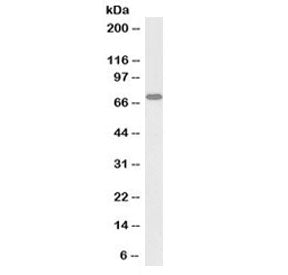 Western blot testing of human Jurkat lysate with biotinylated RACGAP1 antibody at 1ug/ml. Predicted