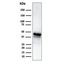 Western blot testing of human Y79 cell lysate using GLUL antibody (clone GLUL/6604). Predicted molec