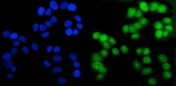 Immunofluorescent staining of FFPE human T-47D cells with AR antibody (green) and DAPI nuclear stain