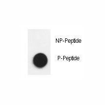 Dot blot analysis of phospho-Nephrin antibody. 50ng of phos-peptide or nonphos-peptide per dot were