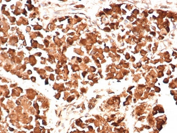 IHC testing of FFPE human pituitary gland stained with ACTH antibody (clone AH26). HIER: boil tissue
