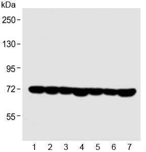 HSP70 Antibody / HSPA1A / HSPA1B