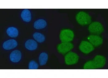 Immunofluorescent staining of FFPE human MCF7 cells with KHSRP antibody (green) and DAPI nuclear sta