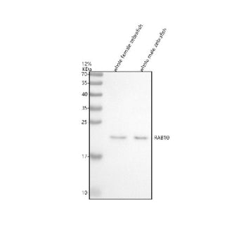 Western blot analysis of Rab10 protein using Zebrafish Rab10 antibody and 1) whole female zebrafish