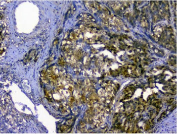 p62 Antibody