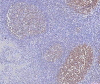POU2AF1 Antibody / BOB-1