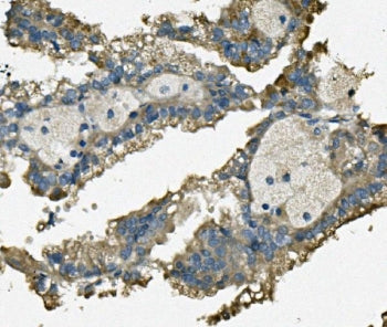 FIS1 Antibody / TTC11