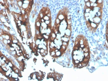 CEA Antibody / Carcinoembryonic Antigen