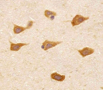 PREX1 Antibody