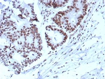 p57 Antibody / p57Kip2