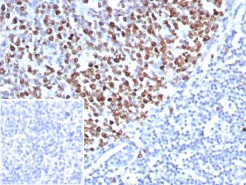 Topoisomerase II alpha Antibody / TOP2A