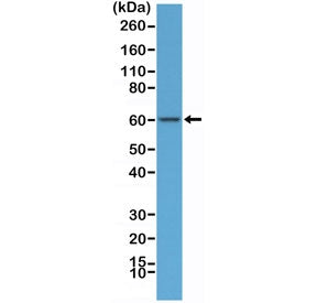 AMPK alpha 1 Antibody / PRKAA1 / C-Terminal Region