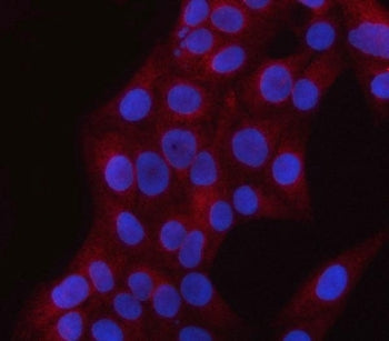 Immunofluorescent staining of FFPE human U-2 OS cells with PNPLA6 antibody (red) and DAPI nuclear st