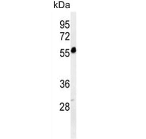 Western blot testing of human K562 cell lysate with FOLH1B antibody. Predicted molecular weight ~50