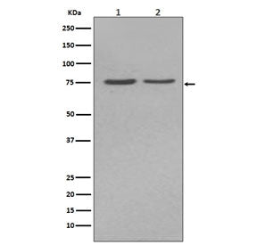 Tissue-nonspecific Alkaline Phosphatase Antibody / ALPL