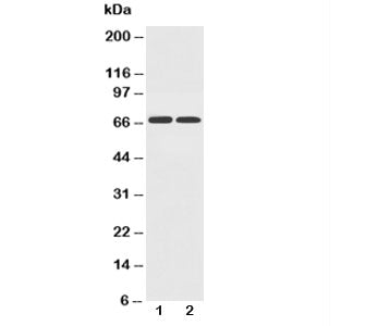 Western blot testing of GLUT12 antibody and Lane 1: PC-12; 2: A549 cell lysate