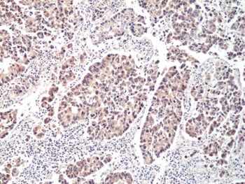 P70 S6 Kinase Antibody / P70S6K