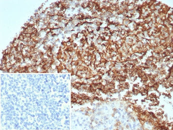 CD35 Antibody / CR1