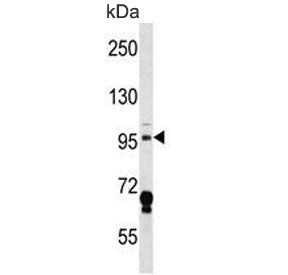 Map4k3 Antibody / Mekkk3 / Glk