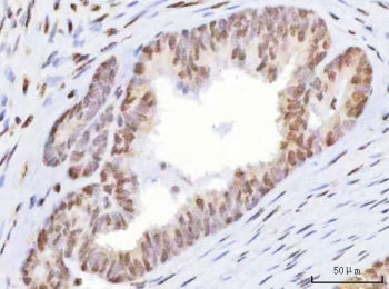 HOXD10 Antibody