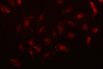 Immunofluorescent staining of FFPE human A549 cells with NFIX antibody (red) and DAPI nuclear stain