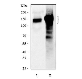 AKAP2 Antibody