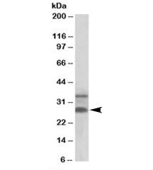 Western blot testing of human skin lysate with C16orf57 antibody at 0.3ug/ml. Predicted molecular we