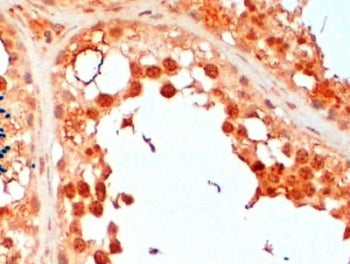 UBC3B Antibody