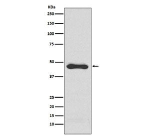 PAI-1 Antibody