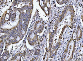 PCCB Antibody / Propionyl-CoA carboxylase beta chain
