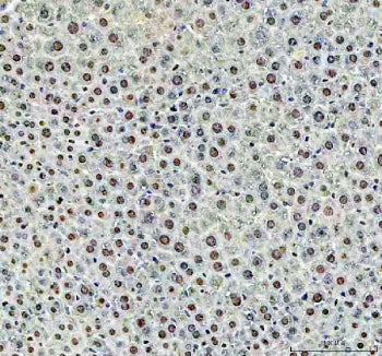 DCK Antibody / Deoxycytidine kinase
