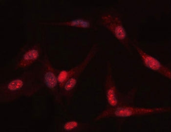 PGK1 Antibody